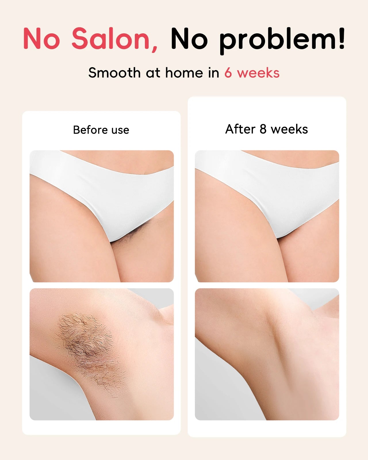 Hair Removal Laser IPL 22J Unlimted IGBT 5.2 cm² light